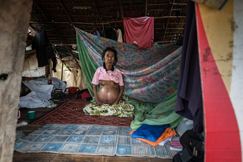 โรคตับ, แม่ตาวคลินิก, ผู้ป่วย