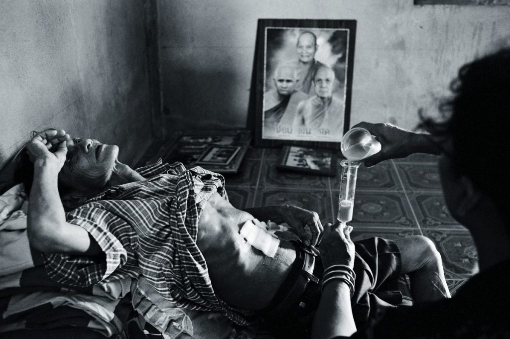 เจาะช่องท้อง, เนื้อร้าย