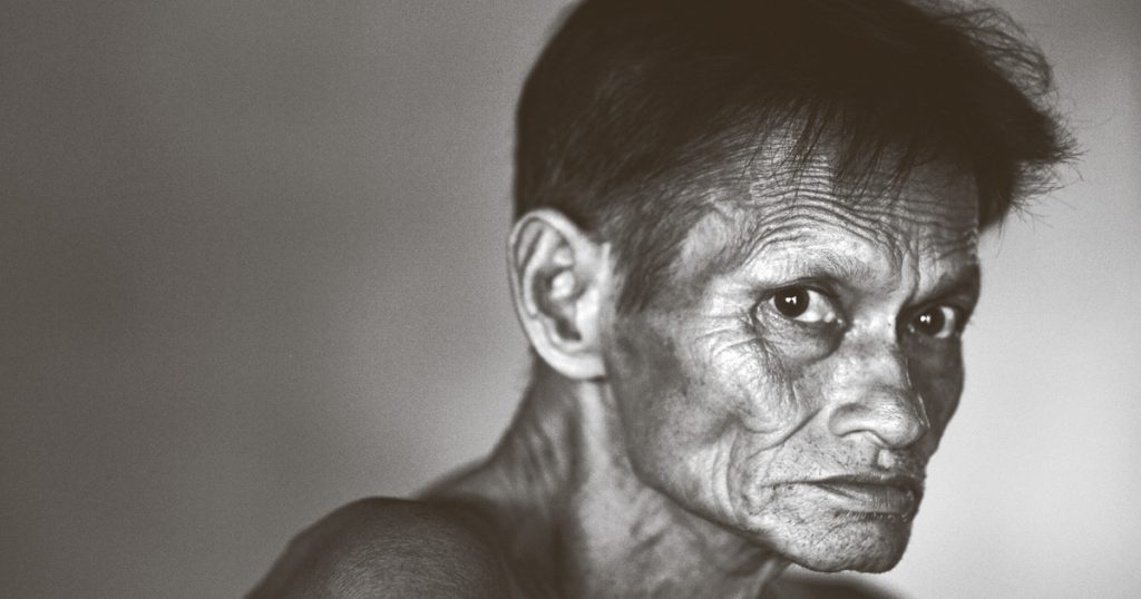 เนื้อร้าย