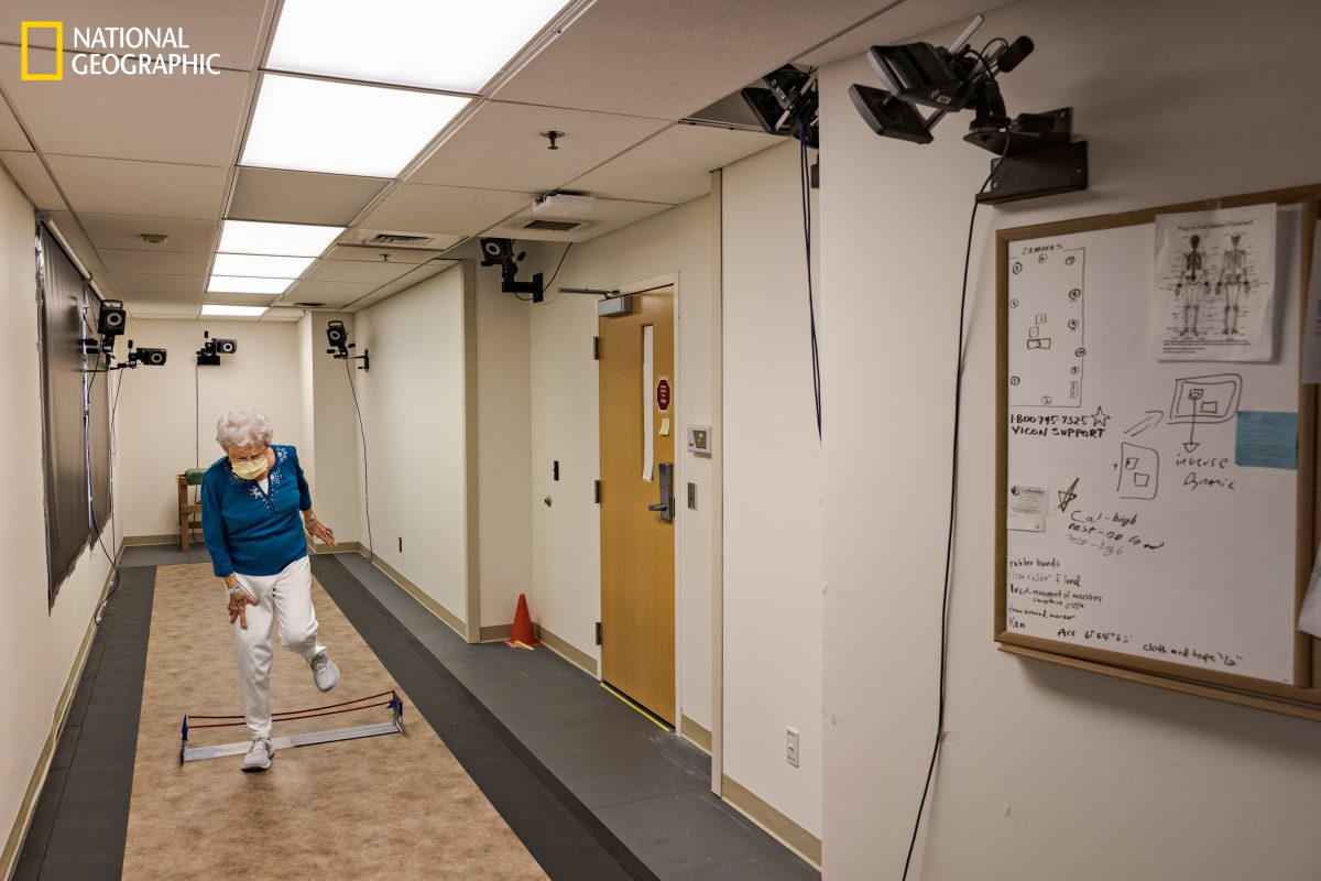 ชะลอวัย