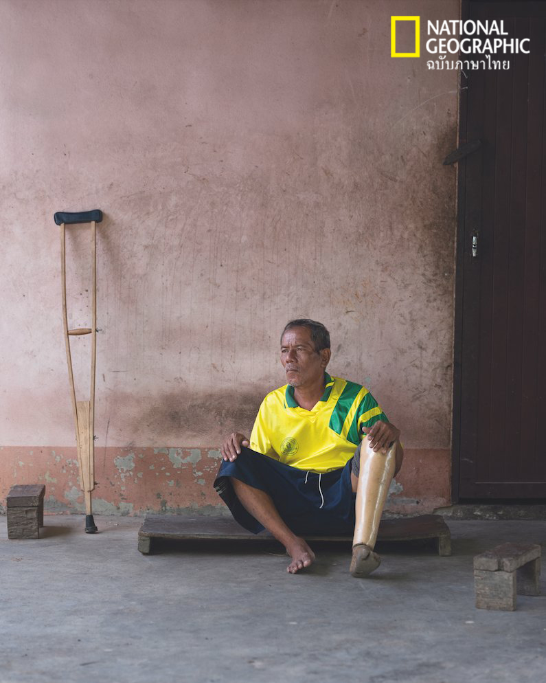 ทุ่นระเบิด, เหยื่อทุ่นระเบิด, คนพิการ, ขาเทียม