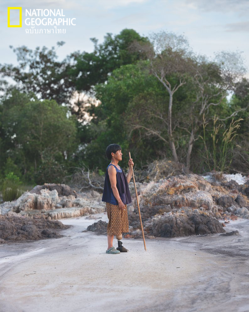 ทุ่นระเบิด, เหยื่อทุ่นระเบิด,