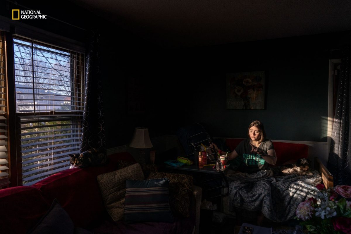 สมองเสื่อม, อัลไซเมอร์