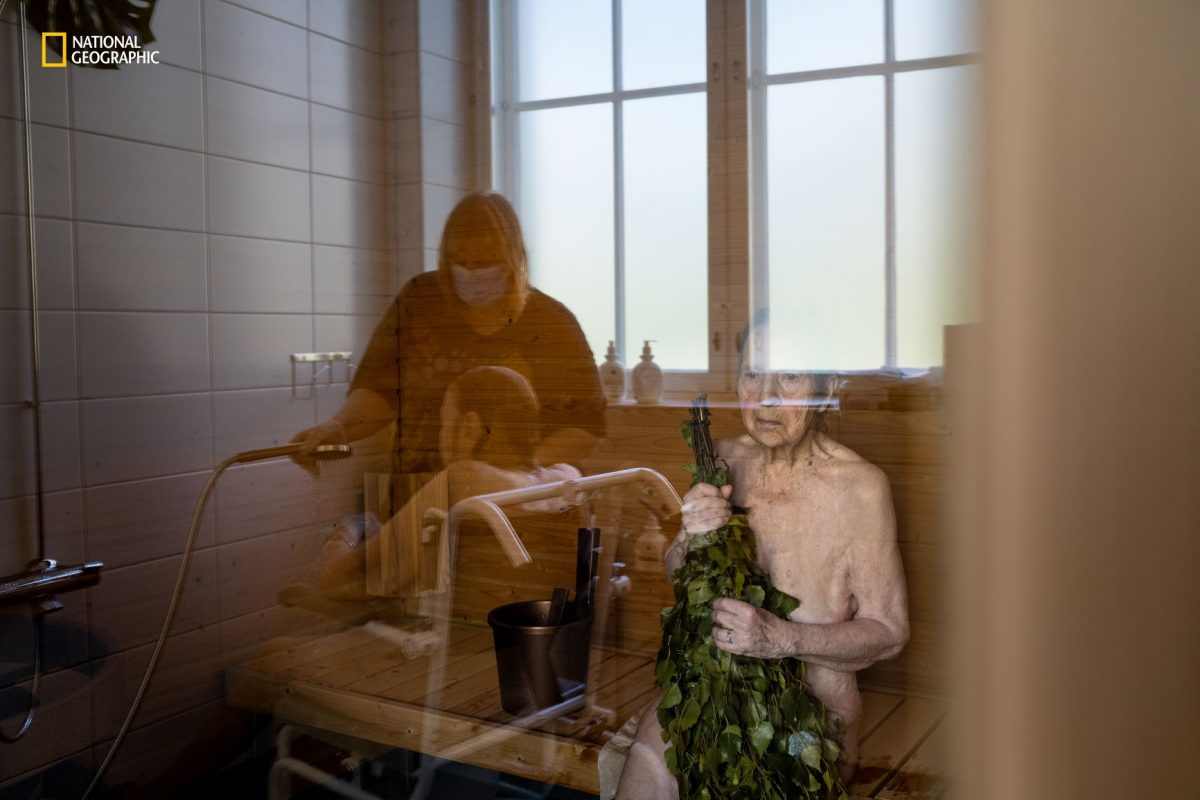 สมองเสื่อม, อัลไซเมอร์